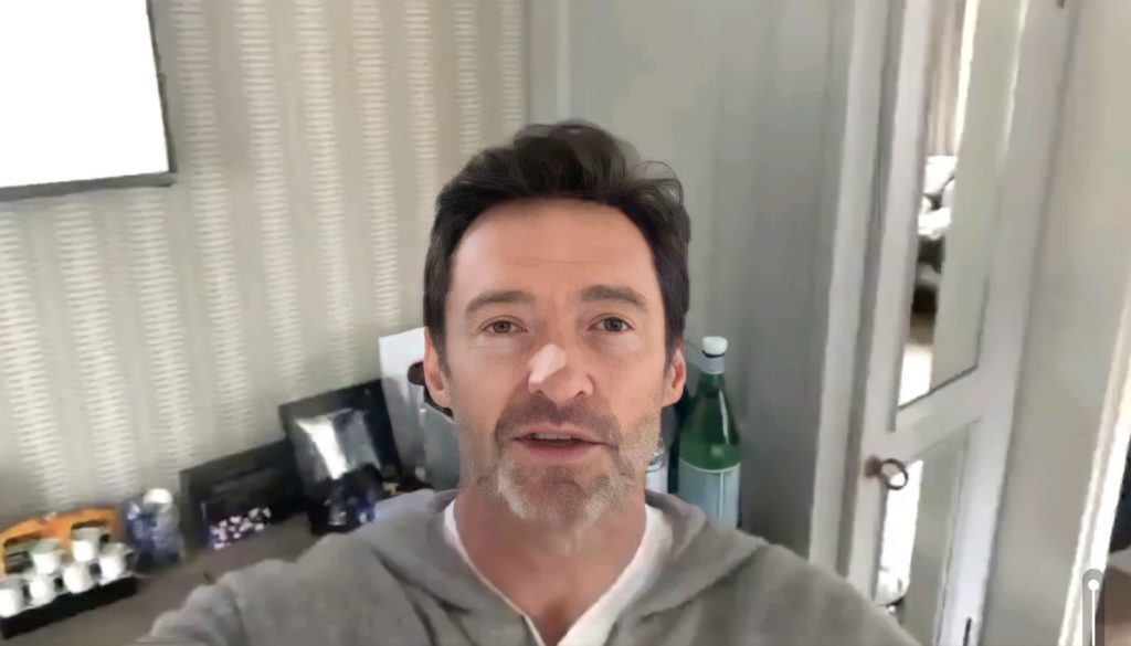 Is Basal Cell Carcinoma Serious? Let’s Ask Hugh Jackman.