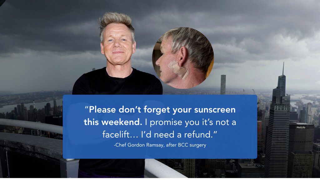 Gordon Ramsay’s Skin Cancer: The News Heard Around the World