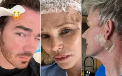 Celebs Who Have Had Skin Cancer — and What They Do Now to Prevent Recurrence